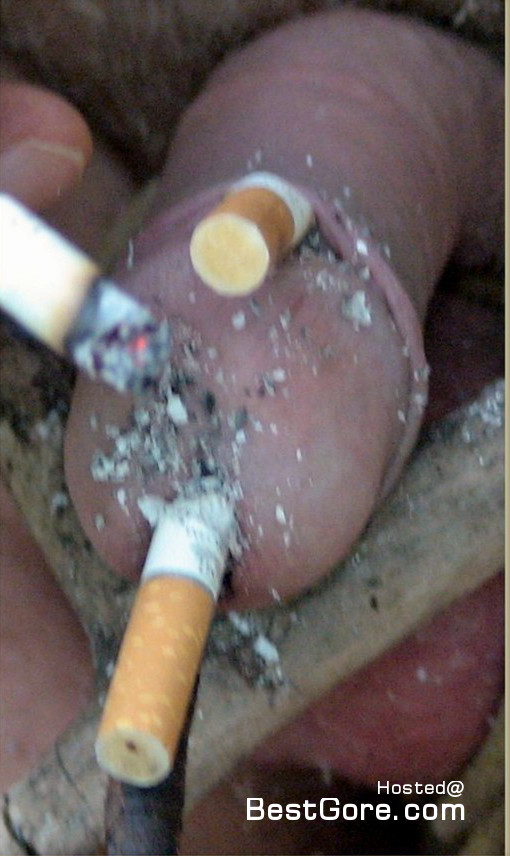 Cigarette Burn Porn