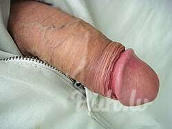 Голд (27 лет)