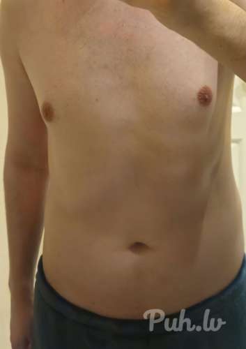 Bottom for top (24 aastat)